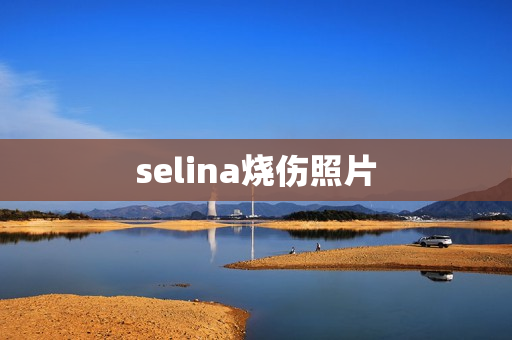 selina烧伤照片