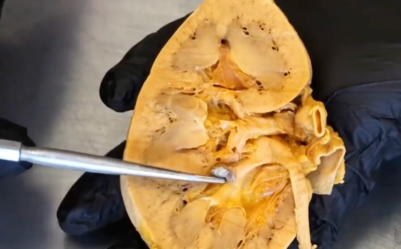 宵夜对肾脏的致命打击：不要再深夜吃饭了！ - php中文网