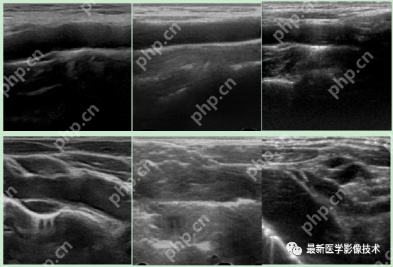 USenhance2023——2023 年超声图像增强挑战赛