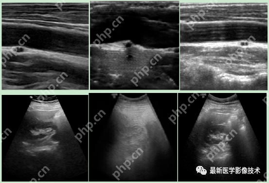 USenhance2023——2023 年超声图像增强挑战赛
