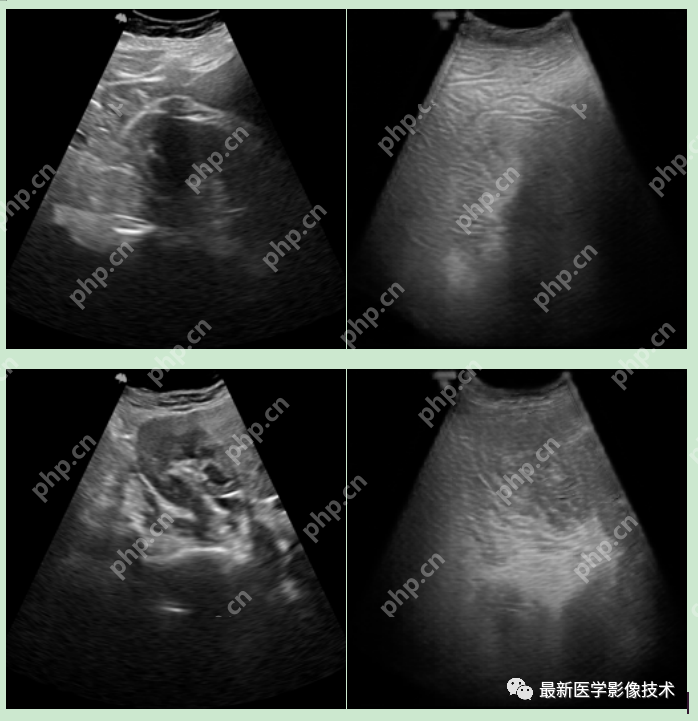 USenhance2023——2023 年超声图像增强挑战赛